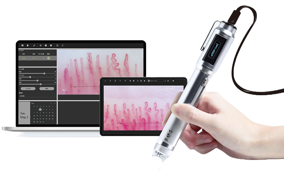 血流測定によるコンディション診断